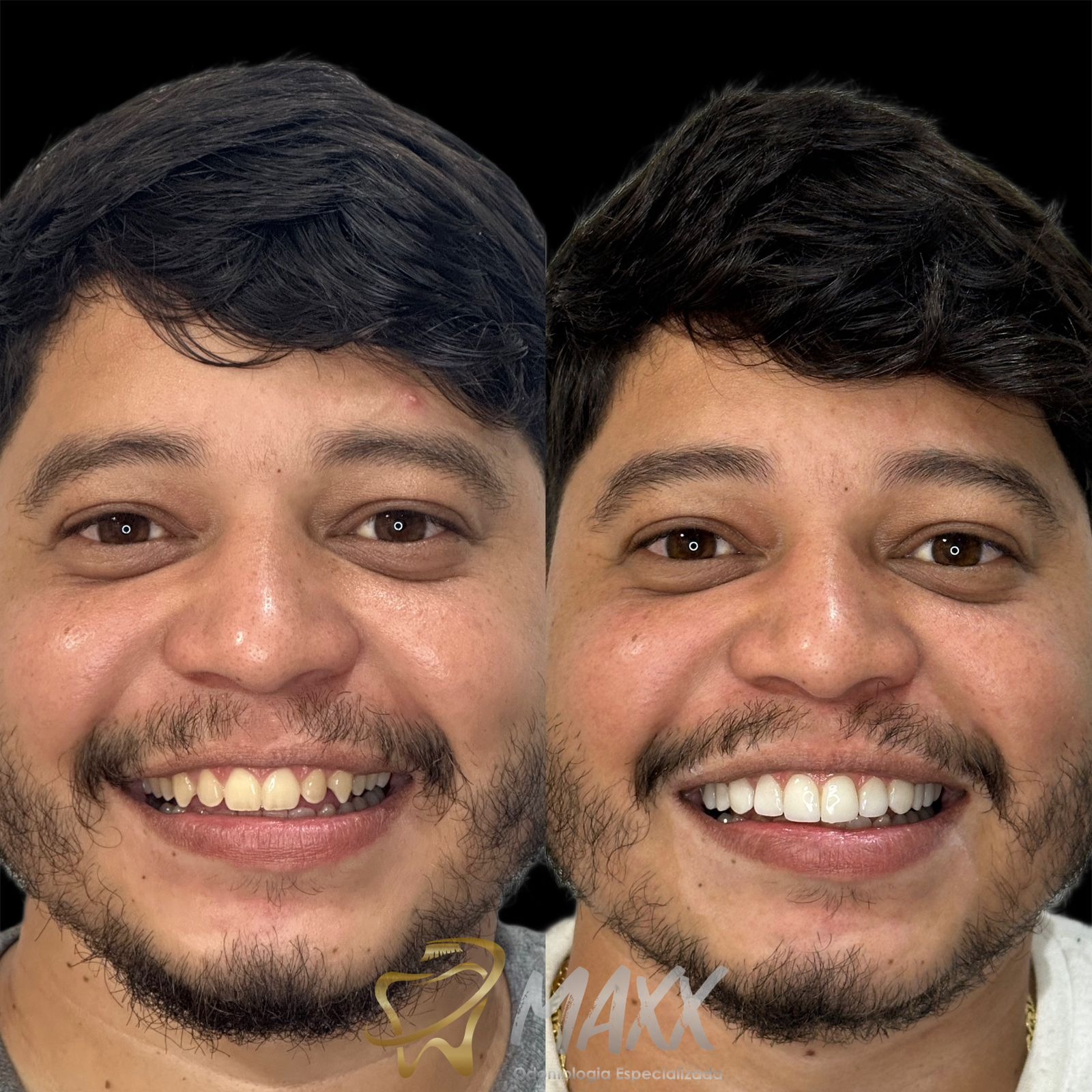 9cd70fa26cbe03aa49a0a8147af6ba74