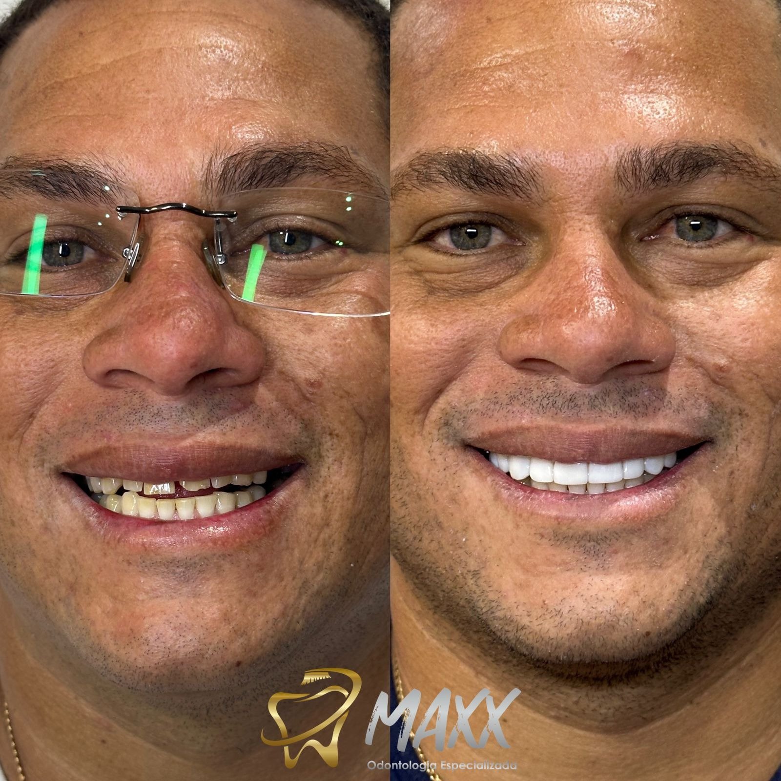 b85ae2c3c64cd68fbec0240366d7851d